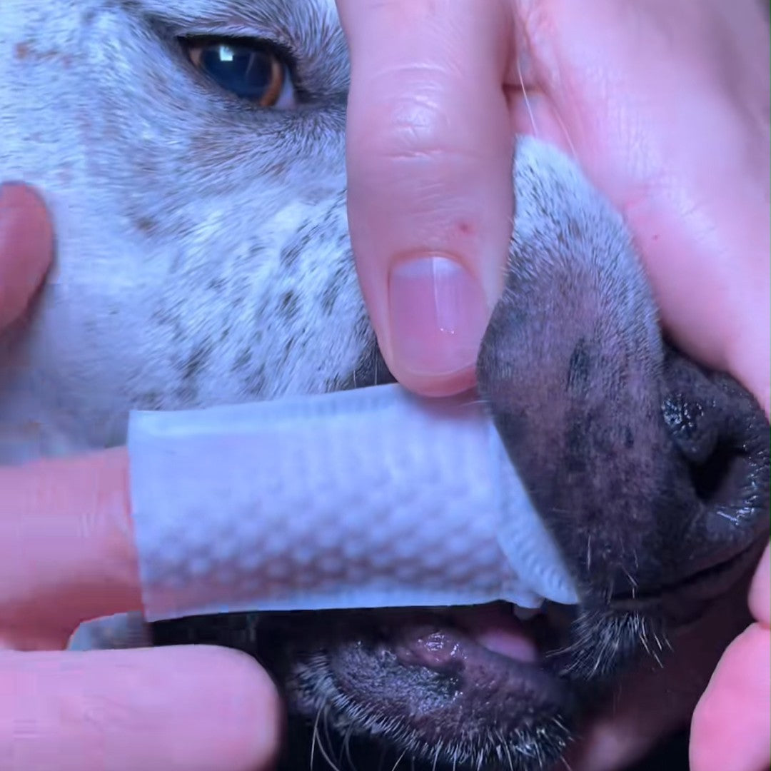 Dental Finger Wipes