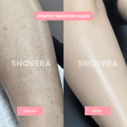 Ahlwo™ Natural Hair Removal Serum - Cyperus Rotundus Oil