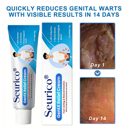 Seurico® HPV Genital Warts Relief Cream