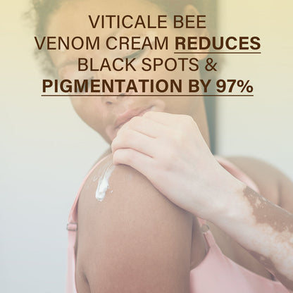 JEREMYTIS® VitiClear Bee Venom Cream Ultra