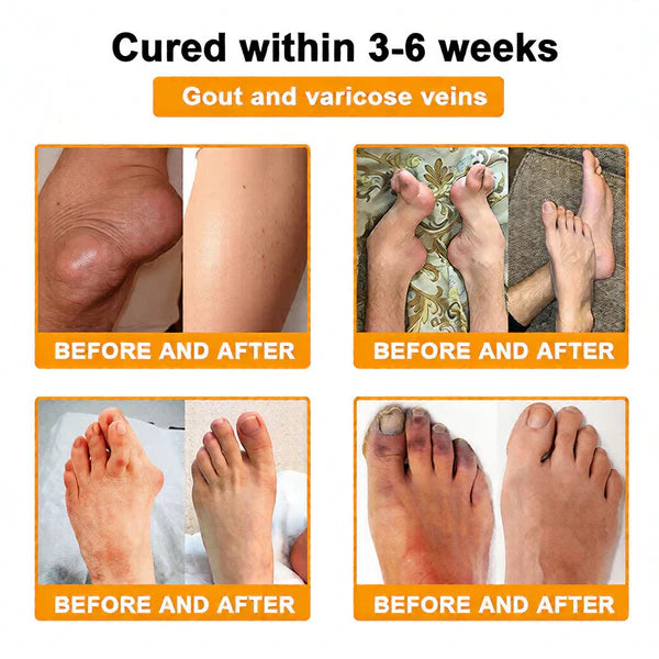 🏆50K+ SOLD LAST WEEK! 🌿HOUKEA Bee Poison Pain-Relief Bone Healing Cream -8JX3