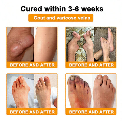 🏆50K+ SOLD LAST WEEK! 🌿HOUKEA Bee Poison Pain-Relief Bone Healing Cream -8JX3