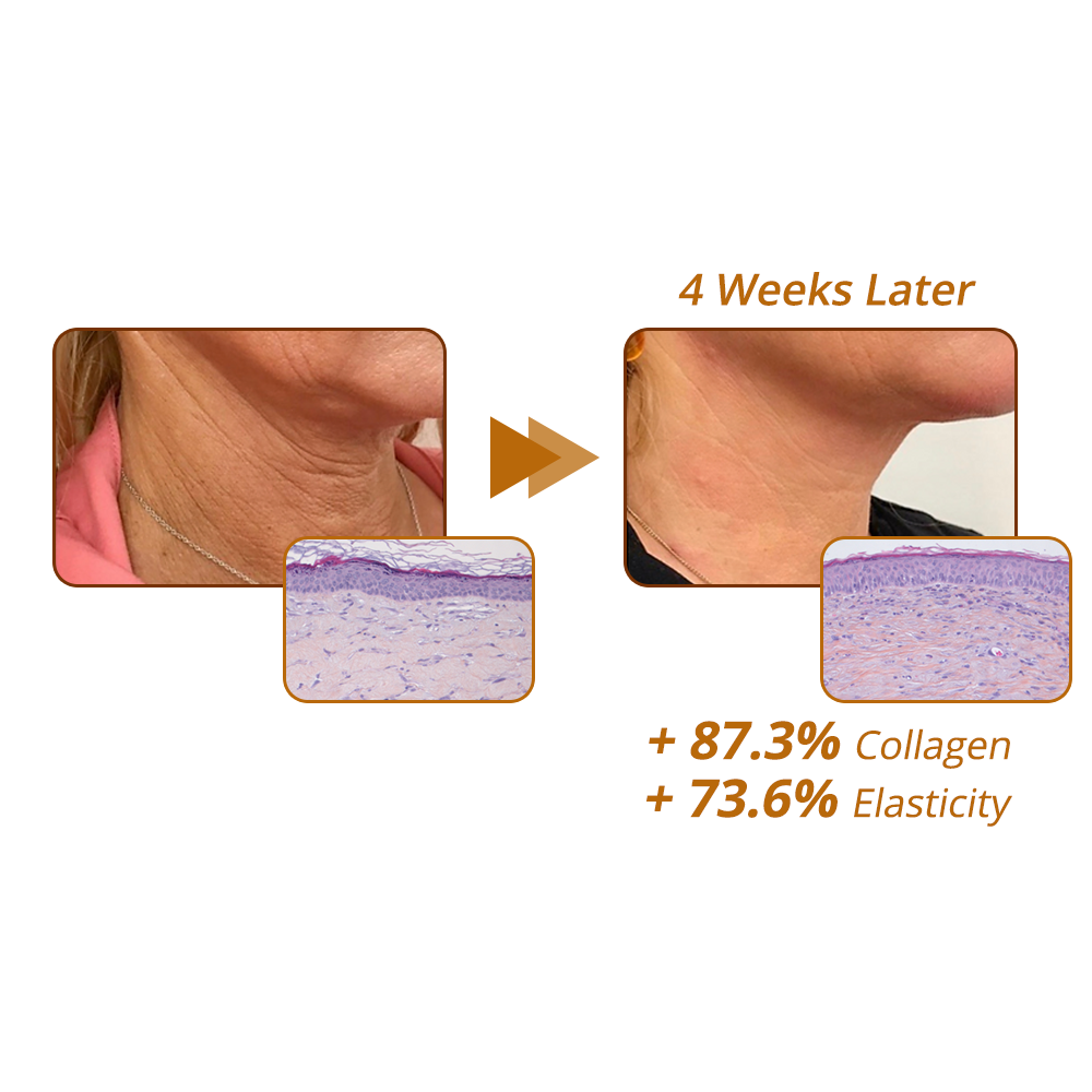 Seurico™ RevitaPeptide Reversal Serum ✨ Tightens & Lifts | Reduces Wrinkles & Fine Lines | Boosts Skin Elasticity 💛