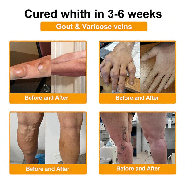🏆50K+ SOLD LAST WEEK! 🌿HOUKEA Bee Poison Pain-Relief Bone Healing Cream -8JX3
