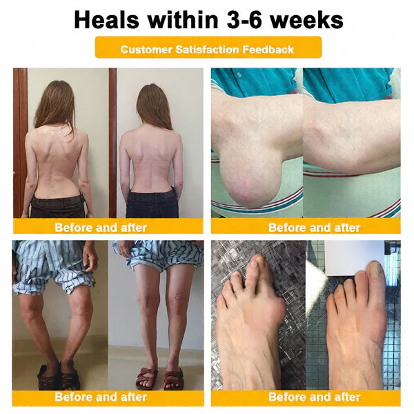 🏆50K+ SOLD LAST WEEK! 🌿HOUKEA Bee Poison Pain-Relief Bone Healing Cream -8JX3