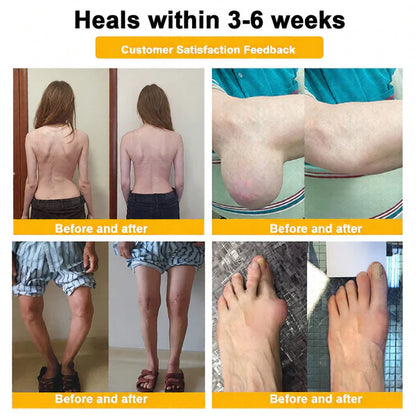 🏆50K+ SOLD LAST WEEK! 🌿HOUKEA Bee Poison Pain-Relief Bone Healing Cream -8JX3