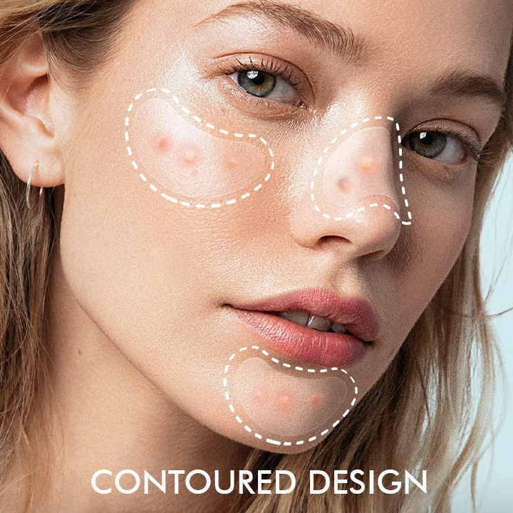 Seurico™ Overnight Hydrocolloid Acne Clear Patches