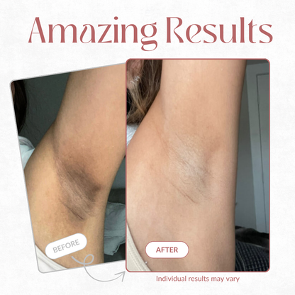 Seurico Peel Shot - Kojic + Turmeric Body Peel Spray