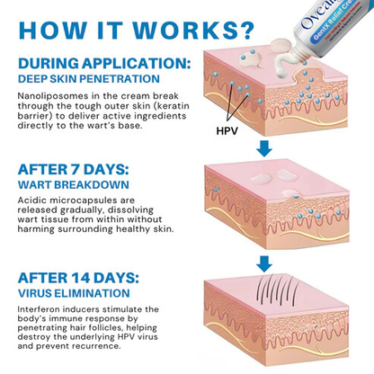 Seurico® HPV Genital Warts Relief Cream