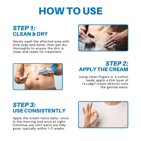 Seurico® HPV Genital Warts Relief Cream