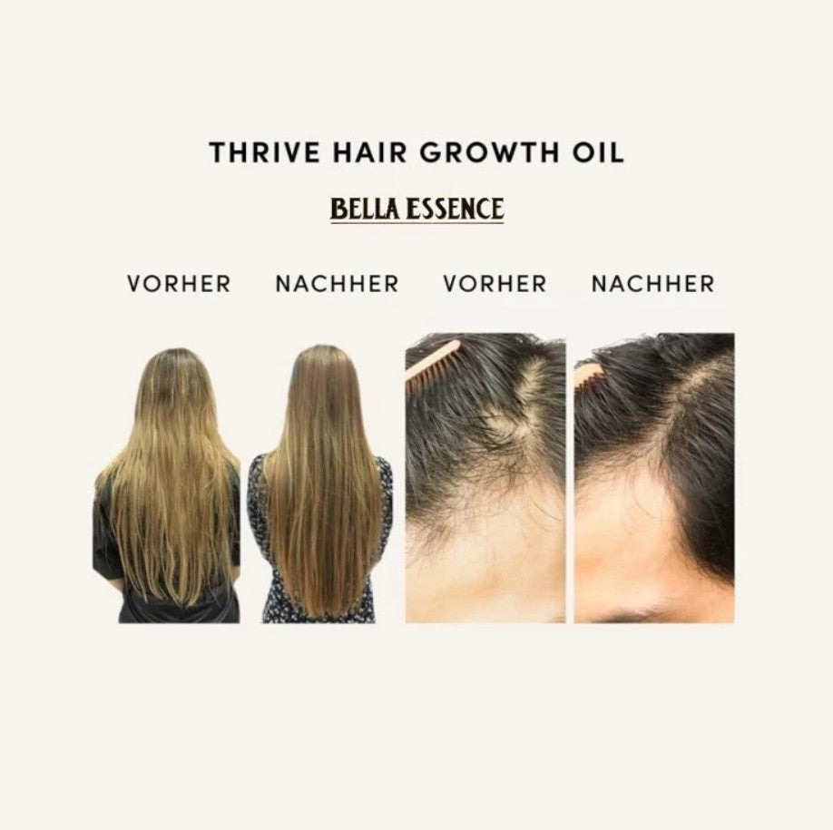 🥇Effective within 30 days - Rosemary Hair Oil