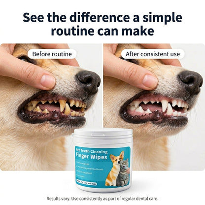 Dental Finger Wipes
