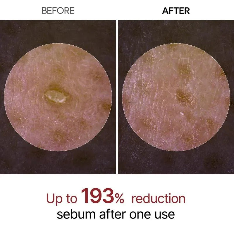 Seurico Peel Shot Glow Rice Ampoule