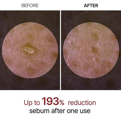 Seurico Peel Shot Glow Rice Ampoule
